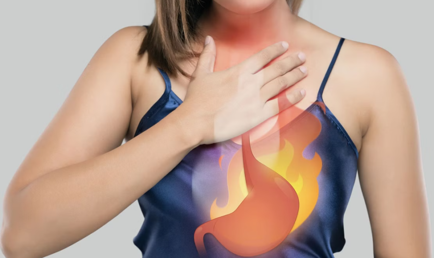 Home Remedy for Heartburn: How to Get Rid of Heartburn Fast