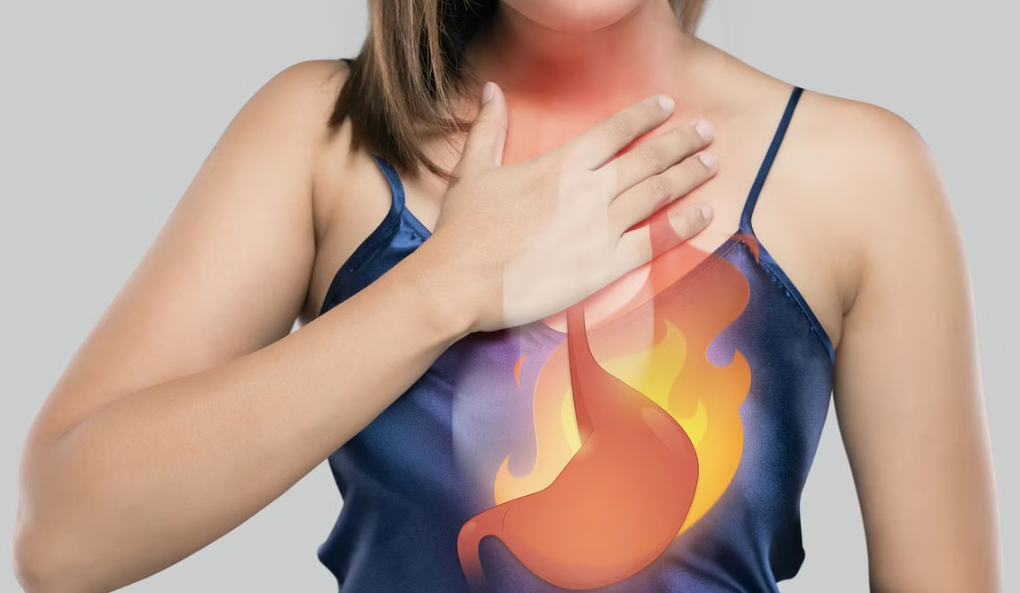 home remedy for heartburn